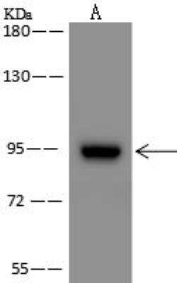 Western Blot: ZNF711 Antibody [NBP3-12580] - Lane A: OVCAR-3 Whole Cell LysateLysates/proteins at 30 ug per lane.SecondaryGoat Anti-Rabbit IgG (H+L)/HRP at 1/10000 dilution.Developed using the ECL technique.Performed under reducing conditions.Predicted band size:87 kDa