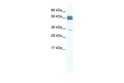Western Blot ZNF713 Antibody - BSA Free