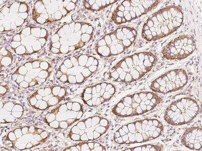 Immunohistochemistry-Paraffin ZNF720 Antibody - BSA Free