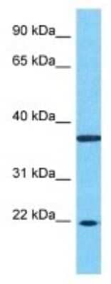 Western Blot: ZNF726 Antibody [NBP3-09927] - Western blot analysis of ZNF726 in 721_B Whole Cell lysates. Antibody dilution at 1.0ug/ml