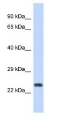 Western Blot: ZNF732 Antibody [NBP3-09195] - Western blot analysis of ZNF732 in Human Fetal Muscle. Antibody dilution at 1ug/ml