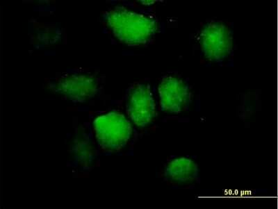 Immunocytochemistry/Immunofluorescence: ZNF74 Antibody [H00007625-B01P] - Analysis of purified antibody to ZNF74 on HeLa cell. (antibody concentration 10 ug/ml)