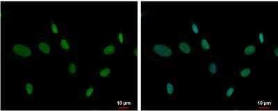 Immunocytochemistry/Immunofluorescence: ZNF74 Antibody [NBP2-21047] - SK-N-SH cells were fixed in 4% paraformaldehyde at RT for 15 min. Green: ZNF74 protein stained by ZNF74 antibody [C1C3] diluted at 1:500. Blue: Hoechst 33342 staining.