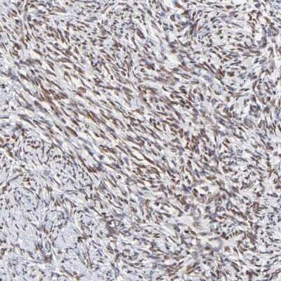 Immunohistochemistry-Paraffin ZNF74 Antibody