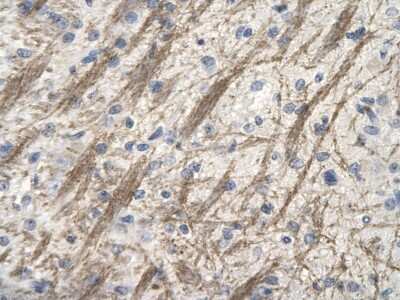 Immunohistochemistry-Paraffin: ZNF74 Antibody [NBP2-88731] - Rabbit Anti-ZNF74 antibody. Paraffin Embedded Tissue: Human Brain cell. Cellular Data: Epithelial cells of renal tubule. Antibody Concentration: 4.0-8.0 ug/ml. Magnification: 400X