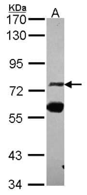 Western Blot: ZNF74 Antibody [NBP2-21047] - Sample (30 ug of whole cell lysate) A: A431 7. 5% SDS PAGE gel, diluted at 1:5000.