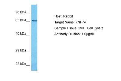 Western Blot: ZNF74 Antibody [NBP2-88732] - Host: Rabbit. Target Name: ZNF74. Sample Type: 293T Whole Cell lysates. Antibody Dilution: 1.0ug/ml