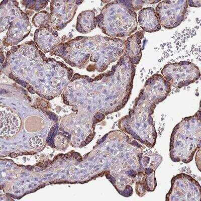 Immunohistochemistry: ZNF746 Antibody [NBP2-13594] - Staining of human placenta shows strong cytoplasmic positivity in trophoblastic cells.
