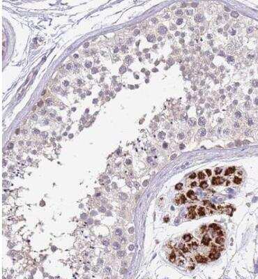 Immunohistochemistry-Paraffin: ZNF746 Antibody [NBP2-13594] - Staining of human testis shows strong cytoplasmic positivity in Leydig cells.