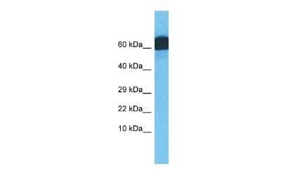 Western Blot: ZNF746 Antibody [NBP2-83902] - Host: Rabbit. Target Name: ZNF746. Sample Type: Lymph Node Tumor lysates. Antibody Dilution: 1.0ug/ml