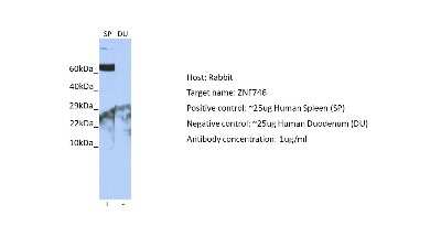 Western Blot: ZNF746 Antibody [NBP2-83902] - Host: Rabbit. Target: ZNF746. Positive control (+): Human Spleen (SP). Negative control (-): Human Duodenum (DU). Antibody concentration: 1ug/ml