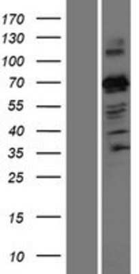 Western Blot: ZNF746 Overexpression Lysate (Adult Normal) [NBP2-05348] Left-Empty vector transfected control cell lysate (HEK293 cell lysate); Right -Over-expression Lysate for ZNF746.