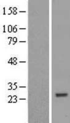 Western Blot: ZNF747 Overexpression Lysate (Adult Normal) [NBL1-18243] Left-Empty vector transfected control cell lysate (HEK293 cell lysate); Right -Over-expression Lysate for ZNF747.