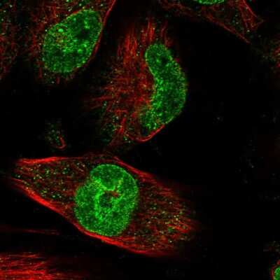 Immunocytochemistry/Immunofluorescence: ZNF749 Antibody [NBP1-93996] - Staining of human cell line U-251 MG shows localization to nucleoplasm & nuclear membrane. Antibody staining is shown in green.