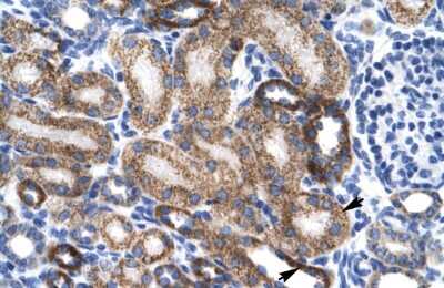 Immunohistochemistry ZNF75 Antibody - BSA Free