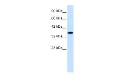Western Blot ZNF75 Antibody - BSA Free