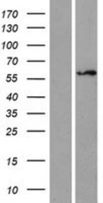 Western Blot ZNF75 Overexpression Lysate