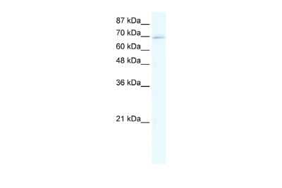 Western Blot: ZNF750 Antibody [NBP2-86556] - WB Suggested Anti-ZINC FINGER PROTEIN 750 Antibody Titration: 5ug/ml. Positive Control: HepG2 cell lysate