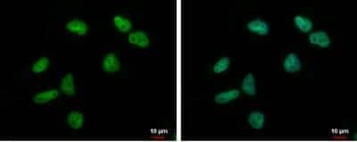 Immunocytochemistry/Immunofluorescence: ZNF76 Antibody [NBP2-21048] -  NT2D1 cells were fixed in 4% paraformaldehyde at RT for 15 min. Green: ZNF76 protein stained by ZNF76 antibody  diluted at 1:2000. Blue: Hoechst 33342 staining.