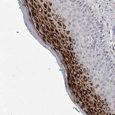 Immunohistochemistry-Paraffin ZNF76 Antibody