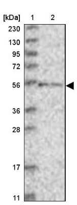 Western Blot ZNF76 Antibody