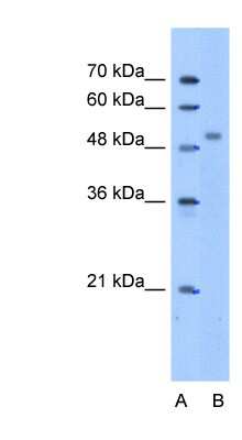 Western Blot ZNF763 Antibody - BSA Free