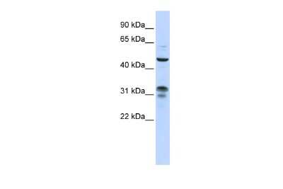 Western Blot ZNF765 Antibody - BSA Free