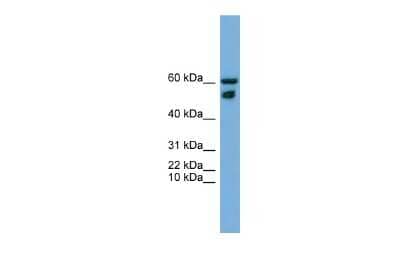 Western Blot ZNF765 Antibody - BSA Free