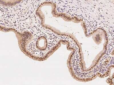 Immunohistochemistry-Paraffin: ZNF766 Antibody [NBP2-98465] - Immunochemical staining of human ZNF766 in human gallbladder with rabbit polyclonal antibody at 1:100 dilution, formalin-fixed paraffin embedded sections.