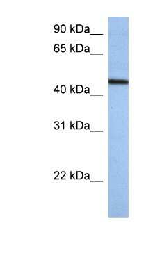 Western Blot: ZNF766 Antibody [NBP1-79354] - Hela cell lysate, concentration 0.2-1 ug/ml.