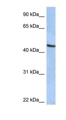 Western Blot: ZNF766 Antibody [NBP1-79355] - Hela cell lysate, concentration 0.2-1 ug/ml.