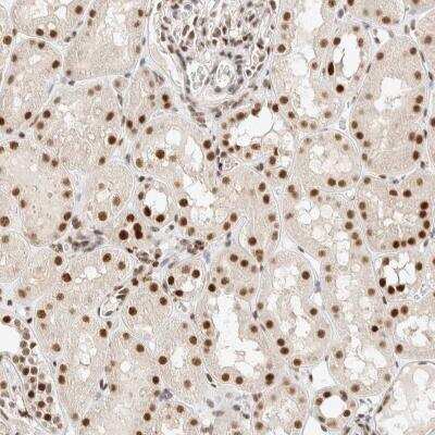 Immunohistochemistry: ZNF768 Antibody [NBP1-83586] - Immunohistochemical staining of human kidney shows strong nuclear positivity in cells in tubules.