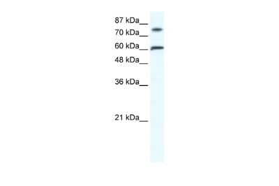 Western Blot: ZNF768 Antibody [NBP2-88734] - WB Suggested Anti-FLJ23436 Antibody Titration: 1.25ug/ml. Positive Control: Raji cell lysateZNF768 is supported by BioGPS gene expression data to be expressed in Raji