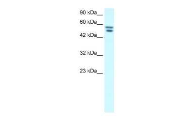Western Blot: ZNF768 Antibody [NBP2-88735] - WB Suggested Anti-FLJ23436 Antibody Titration: 1.25ug/ml. Positive Control: HepG2 cell lysate