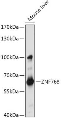 Western Blot: ZNF768 Antibody [NBP2-94393] - Analysis of extracts of Mouse liver, using ZNF768 at 1:1000 dilution.Secondary antibody: HRP Goat Anti-Rabbit IgG (H+L) at 1:10000 dilution.Lysates/proteins: 25ug per lane.Blocking buffer: 3% nonfat dry milk in TBST.Detection: ECL Basic Kit .Exposure time: 30s.