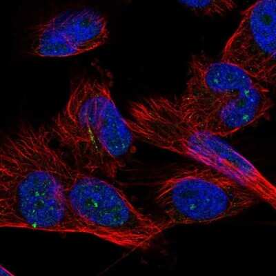 Immunocytochemistry/Immunofluorescence: ZNF77 Antibody [NBP1-80873] - Staining of human cell line U-251 MG shows localization to nucleus &amp; nucleoli.