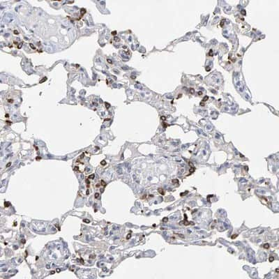 Immunohistochemistry-Paraffin: ZNF77 Antibody [NBP1-80873] - Staining of human lung shows strong cytoplasmic positivity in subsets of alveolar cells.