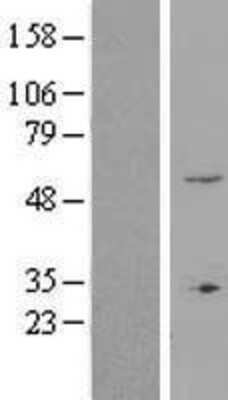 Western Blot ZNF77 Overexpression Lysate
