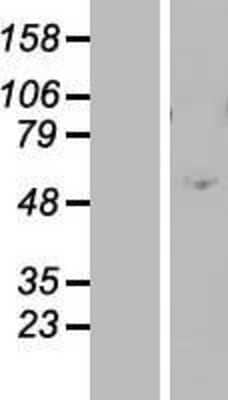 Western Blot ZNF770 Overexpression Lysate