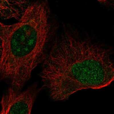 Immunocytochemistry/Immunofluorescence: ZNF771 Antibody [NBP2-55199] - Staining of human cell line U-2 OS shows localization to nucleus & nucleoli.