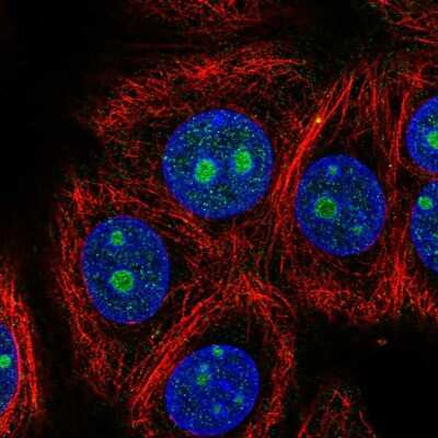 Immunocytochemistry/Immunofluorescence: ZNF771 Antibody [NBP2-55801] - Staining of human cell line MCF7 shows localization to nucleus & nucleoli.