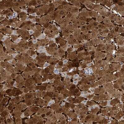 Immunohistochemistry-Paraffin: ZNF771 Antibody [NBP2-13595] - Staining of human liver shows strong cytoplasmic and nuclear positivity in hepatocytes with distinctly stained Kupffer cells.