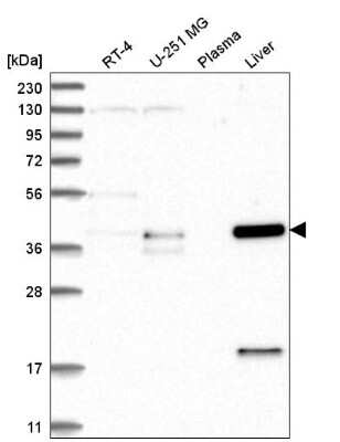 Western Blot: ZNF771 Antibody [NBP2-55199] - Western blot analysis in human cell line RT-4, human cell line U-251 MG, human plasma and human liver tissue.