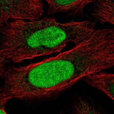 Immunocytochemistry/ Immunofluorescence ZNF776 Antibody - BSA Free