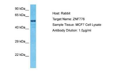 Western Blot: ZNF776 Antibody [NBP2-88738] - Host: Rabbit. Target Name: ZNF776. Sample Type: MCF7 Whole Cell lysates. Antibody Dilution: 1.0ug/ml
