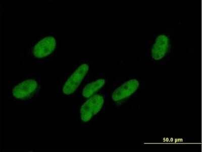 Immunocytochemistry/Immunofluorescence: ZNF777 Antibody [H00027153-B01P] - Analysis of purified antibody to ZNF777 on HepG2 cell. (antibody concentration 10 ug/ml)
