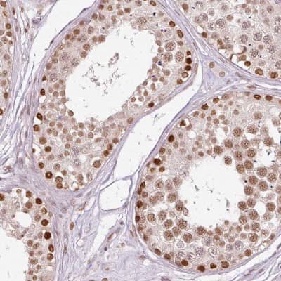 Immunohistochemistry-Paraffin: ZNF778 Antibody [NBP2-33637] - Staining of human testis shows strong nuclear positivity in cells in seminiferus ducts.