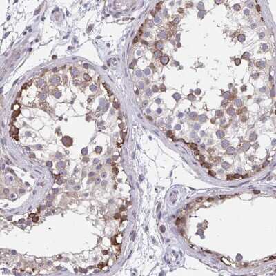 Immunohistochemistry-Paraffin: ZNF778 Antibody [NBP2-33817] - Staining of human testis shows cytoplasmic positivity in cells in seminiferous ducts.