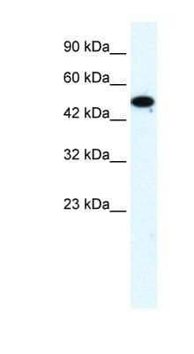 Western Blot: ZNF778 Antibody [NBP1-80195] - Titration: 1.25ug/ml, Positive Control: HepG2 cell lysate.