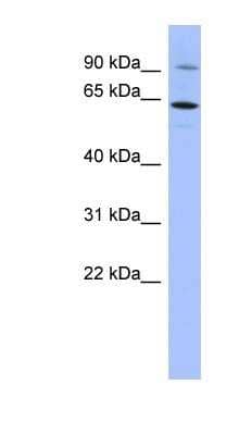 Western Blot: ZNF778 Antibody [NBP1-80436] - PANC1 cell lysate, concentration 0.2-1 ug/ml.